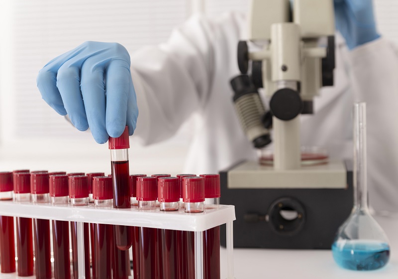 La ciencia detrás de la temperatura de almacenamiento de sangre: ¿Por qué 4 °C es el estándar de oro?